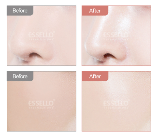 ESSELLO BNC | Collagen Mask Pack